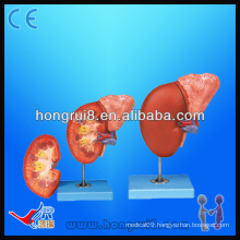 Vivid Medical Human Kidneys sale and pancreas gland model